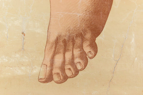Vintage Small Anatomical Poster of a Broken Leg