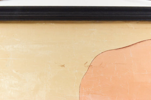Vintage Small Anatomical Poster of a Broken Leg