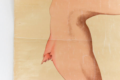 Vintage Small Anatomical Poster of a Broken Leg