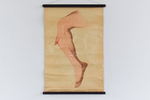 Vintage Small Anatomical Poster of a Broken Leg