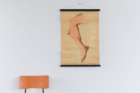 Vintage Small Anatomical Poster of a Broken Leg