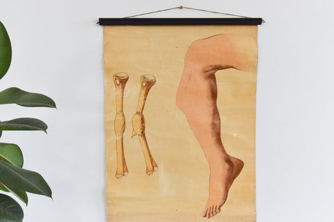 Vintage Small Anatomical Poster of a Broken Leg