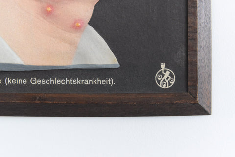 Vintage Small Medical Study 3D Picture German Medical Museum