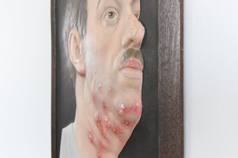 Vintage Small Medical Study 3D Picture German Medical Museum