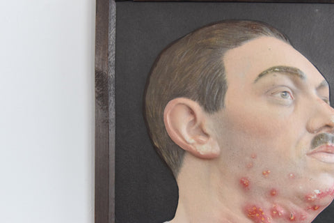 Vintage Small Medical Study 3D Picture German Medical Museum