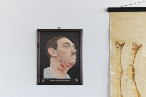 Vintage Small Medical Study 3D Picture German Medical Museum