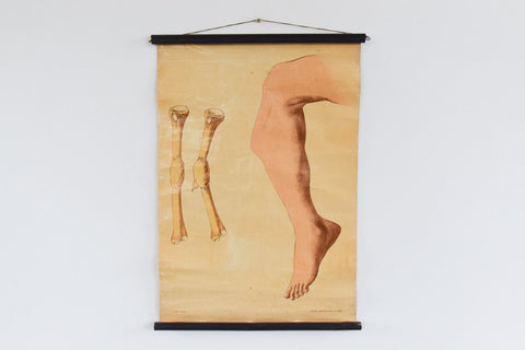Vintage Small Anatomical Poster of a Broken Leg